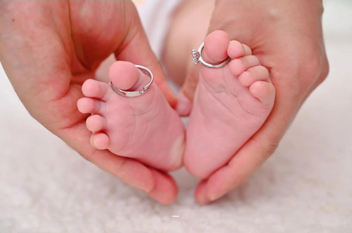 衡东孕妇怎样预防妊娠纹